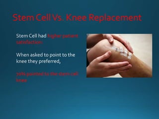 Stem CellVs. Knee Replacement
higher patient
satisfaction:
70% pointed to the stem cell
knee
 
