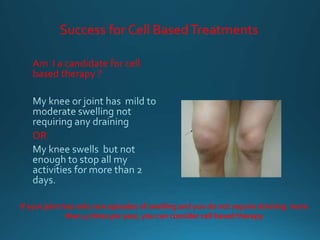 Success for Cell BasedTreatments
Am I a candidate for cell
based therapy ?
OR
If your joint has only rare episodes of swelling and you do not require draining more
than 4 times per year, you can consider cell based therapy
 