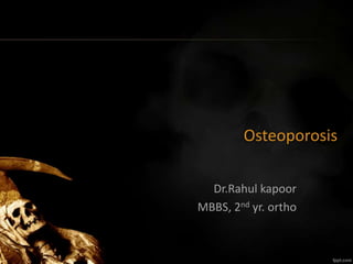 Osteoporosis
Dr.Rahul kapoor
MBBS, 2nd yr. ortho
 