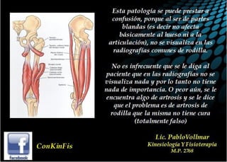 Tendinitis Pata de Ganso