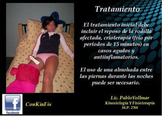 Tendinitis Pata de Ganso