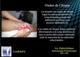 Tendinitis Pata de Ganso