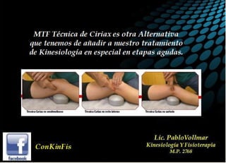 Tendinitis Pata de Ganso