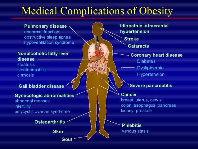 Weight loss rate 5 2 diet photo 5