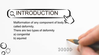 Malformation of any component of body is
called deformity.
There are two types of deformity
a) congenital
b) aquired
INTRODUCTION
 