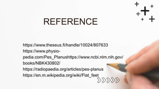 https://www.theseus.fi/handle/10024/807633
https://www.physio-
pedia.com/Pes_Planushttps://www.ncbi.nlm.nih.gov/
books/NBK430802/
https://radiopaedia.org/articles/pes-planus
https://en.m.wikipedia.org/wiki/Flat_feet
REFERENCE
 