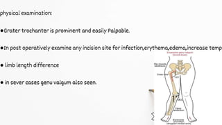 physical examination:
●Grater trochanter is prominent and easily Palpable.
●In post operatively examine any incision site for infection,erythema,edema,increase temp
● limb length difference
● in sever cases genu valgum also seen.
 