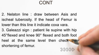 CONT
2. Nelaton line : draw between Asis and
ischeal tuberosity. If the head of Femur is
lower than this line it indicate coxa vara.
3. Galeazzi sign : patient lie supine with hip
45°flexed and knee 90° flexed and both foot
heel at the same level then check the
shortening of femur.
 