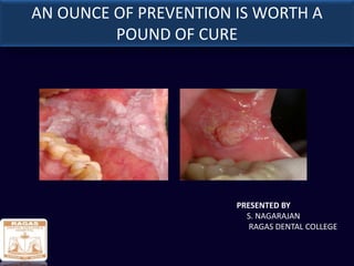 AN OUNCE OF PREVENTION IS WORTH A
POUND OF CURE
PRESENTED BY
S. NAGARAJAN
RAGAS DENTAL COLLEGE
 