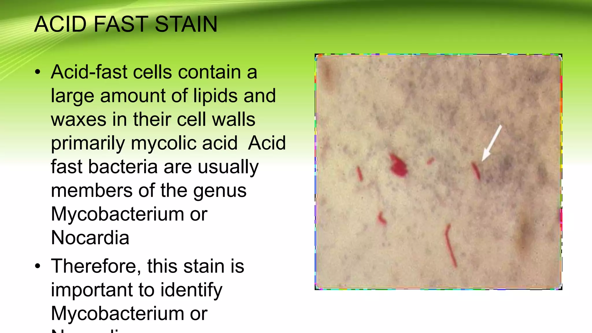 ACID FAST STAIN
• Acid-fast cells contain a
large amount of lipids and
waxes in their cell walls
primarily mycolic acid Acid
fast bacteria are usually
members of the genus
Mycobacterium or
Nocardia
• Therefore, this stain is
important to identify
Mycobacterium or
 