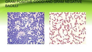 GRAM POSITIVE COCCI AND GRAM NEGATIVE
BACILLI
 