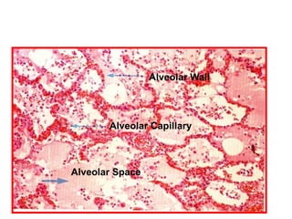 14- Chronic Venous Congestion, Lung
             Low Power



                      Alveolar Wall




            Alveolar Capillary



     Alveolar Space
 