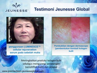 www.premierteam.jeunesseglobal.com
penggunaan LUMINESCE™
cellular rejuvenation
serum pada sebelah muka
Meningkatkan produksi kolagen kulit
sekaligus mengurangi peradangan
(sensitifitas kulit) dan jerawat
Pembuktian dengan dermascope
(pembentukan kembali kolagen
kulit
Testimoni Jeunesse Global
 