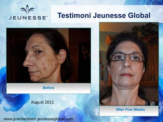 www.premierteam.jeunesseglobal.com
After Five Weeks
Before
August 2011
Testimoni Jeunesse Global
 