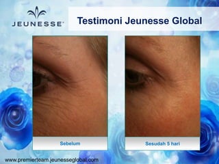www.premierteam.jeunesseglobal.com
Sesudah 5 hariSebelum
Testimoni Jeunesse Global
 