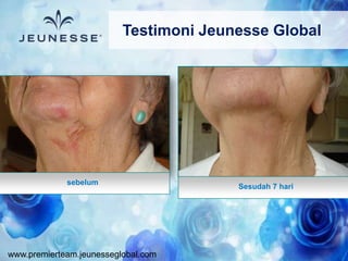 www.premierteam.jeunesseglobal.com
sebelum
Sesudah 7 hari
Testimoni Jeunesse Global
 
