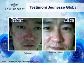 www.premierteam.jeunesseglobal.com
Sebelum Setelah 1 bulan
Testimoni Jeunesse Global
 