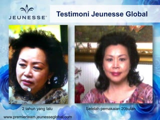 www.premierteam.jeunesseglobal.com
2 tahun yang lalu Setelah pemakaian 20bulan
Testimoni Jeunesse Global
 