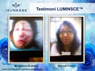 www.premierteam.jeunesseglobal.com
Testimoni LUMINSCE™
Mengalami 40 jahitan Setelah 2 bulan
 