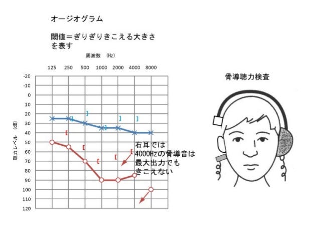新人研修 純音聴力検査