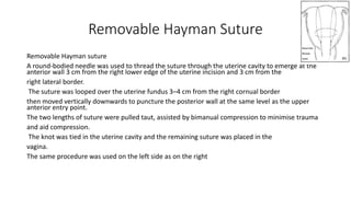 Removable Hayman Suture
Removable Hayman suture
A round-bodied needle was used to thread the suture through the uterine cavity to emerge at the
anterior wall 3 cm from the right lower edge of the uterine incision and 3 cm from the
right lateral border.
The suture was looped over the uterine fundus 3–4 cm from the right cornual border
then moved vertically downwards to puncture the posterior wall at the same level as the upper
anterior entry point.
The two lengths of suture were pulled taut, assisted by bimanual compression to minimise trauma
and aid compression.
The knot was tied in the uterine cavity and the remaining suture was placed in the
vagina.
The same procedure was used on the left side as on the right
 