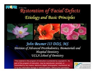 Restoration of Facial Defects
             Etiology and Basic Principles




               John Beumer III DDS, MS
Division of Advanced Prosthodontics, Biomaterials and
                 Hospital Dentistry
              UCLA School of Dentistry
*The material in this program of instruction is protected by copyright ©. No
part of this program of instruction may be reproduced, recorded, or
transmitted by any means, electronic,digital, photographic, mechanical, etc.
or by any information storage or retrieval system, without prior permission.
 
