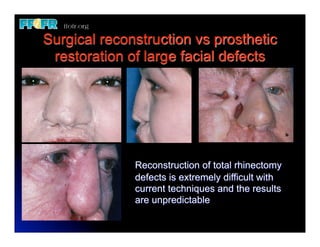 (New) restoration of facial defects basic priniciples | PDF