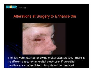 (New) restoration of facial defects basic priniciples | PDF