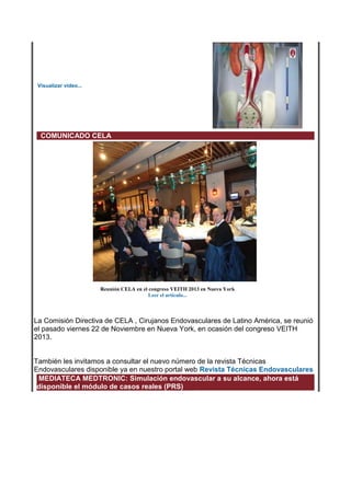 Visualizar vídeo...

COMUNICADO CELA

Leer el artículo...

La Comisión Directiva de CELA , Cirujanos Endovasculares de Latino América, se reunió
el pasado viernes 22 de Noviembre en Nueva York, en ocasión del congreso VEITH
2013.

También les invitamos a consultar el nuevo número de la revista Técnicas
Endovasculares disponible ya en nuestro portal web Revista Técnicas Endovasculares
MEDIATECA MEDTRONIC: Simulación endovascular a su alcance, ahora está
disponible el módulo de casos reales (PRS)

 