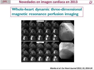 Manka et al. Eur Heart Journal 2012; 33, 2016-24

 