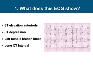 1. What does this ECG show?
 ST elevation anteriorly
 ST depression
 Left bundle branch block
 Long QT interval
 
