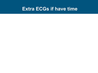 Extra ECGs if have time
 