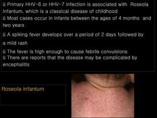 ü Primary HHV-6 or HHV-7 infection is associated with Roseola
Infantum, which is a classical disease of childhood
ü Most cases occur in infants between the ages of 4 months and
two years
ü A spiking fever develops over a period of 2 days followed by
a mild rash
ü The fever is high enough to cause febrile convulsions
ü There are reports that the disease may be complicated by
encephalitis
Roseola infantum
 