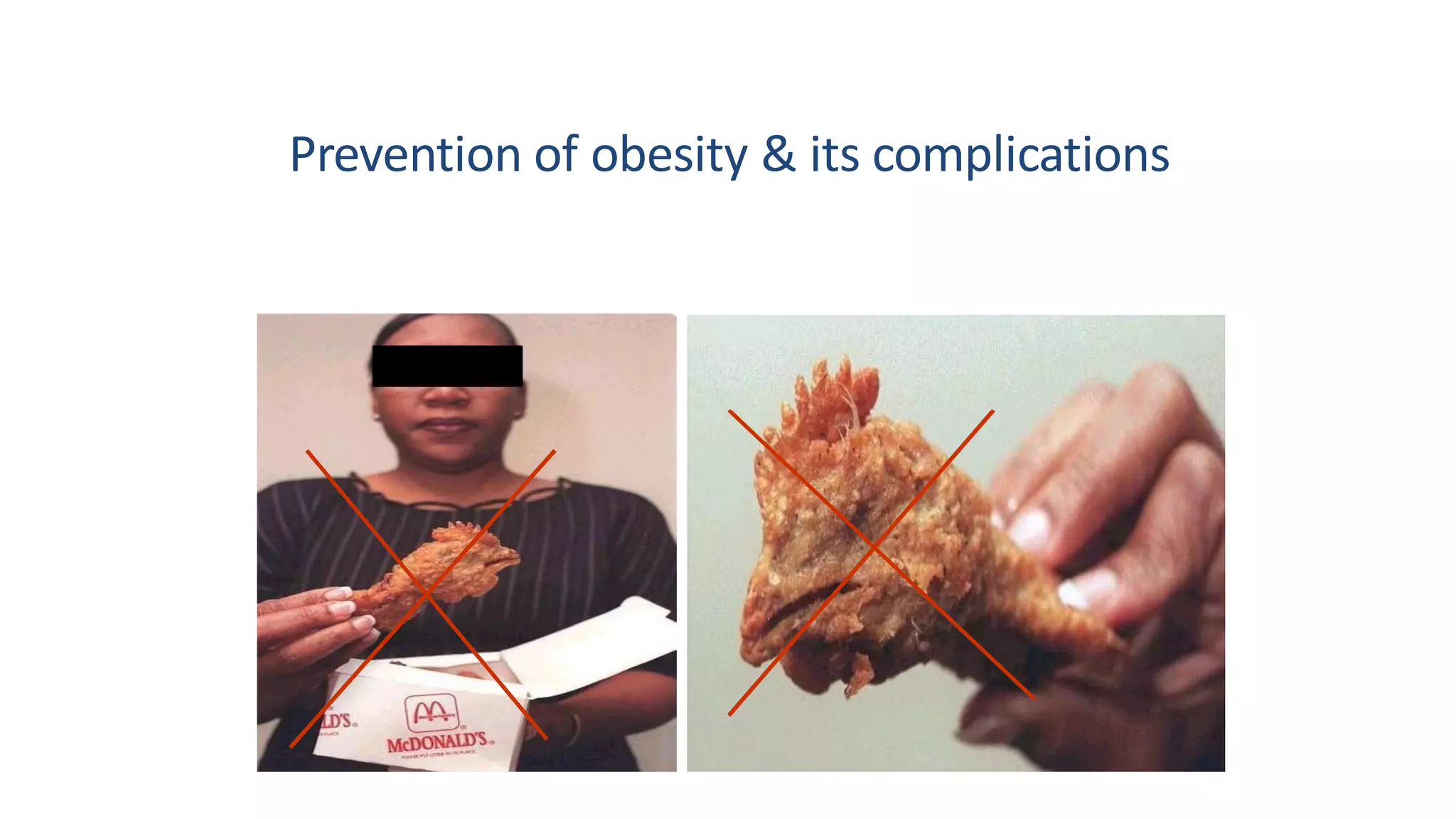 New strategies in management of obesity | PDF