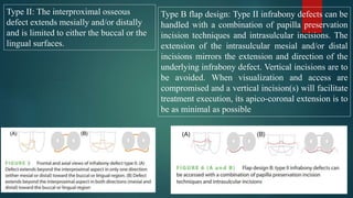 New Surgery Approaches Preserving Entire Papilla To Treat.pptx