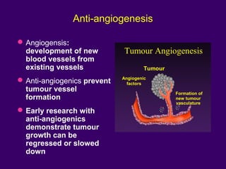 Anti-angiogenesis
Angiogensis:
development of new
blood vessels from
existing vessels
Anti-angiogenics prevent
tumour vessel
formation
Early research with
anti-angiogenics
demonstrate tumour
growth can be
regressed or slowed
down
Tumour Angiogenesis
Formation of
new tumour
vasculature
Tumour
Angiogenic
factors
 