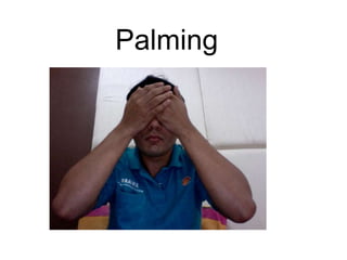 Palming
 