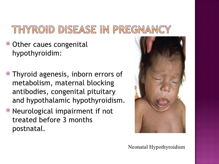 Thyroid Disease in Pregnancy