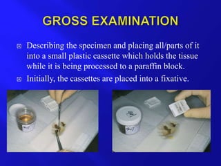  Describing the specimen and placing all/parts of it
into a small plastic cassette which holds the tissue
while it is being processed to a paraffin block.
 Initially, the cassettes are placed into a fixative.
 