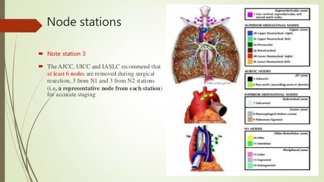New TNM staging for lung cancer
