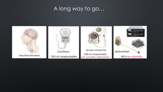 Deep Brain Stimulation
A long way to go…