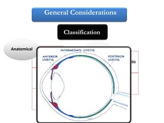New trends in management of uveitis | PPTX