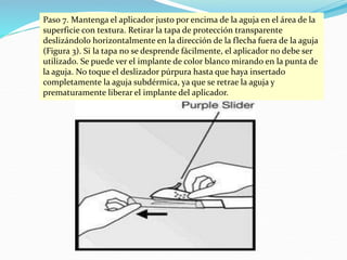 Paso 7. Mantenga el aplicador justo por encima de la aguja en el área de la
superficie con textura. Retirar la tapa de protección transparente
deslizándolo horizontalmente en la dirección de la flecha fuera de la aguja
(Figura 3). Si la tapa no se desprende fácilmente, el aplicador no debe ser
utilizado. Se puede ver el implante de color blanco mirando en la punta de
la aguja. No toque el deslizador púrpura hasta que haya insertado
completamente la aguja subdérmica, ya que se retrae la aguja y
prematuramente liberar el implante del aplicador.
 