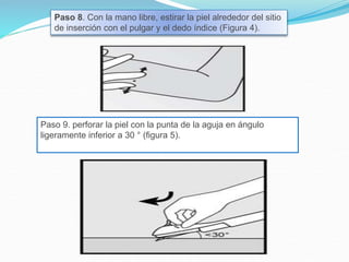 Paso 8. Con la mano libre, estirar la piel alrededor del sitio
de inserción con el pulgar y el dedo índice (Figura 4).
Paso 9. perforar la piel con la punta de la aguja en ángulo
ligeramente inferior a 30 ° (figura 5).
 