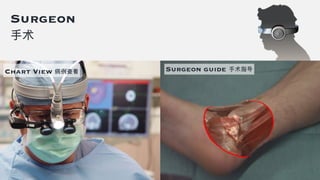 Surgeon
手术
Chart View 病例查看 Surgeon guide 手术指导
 