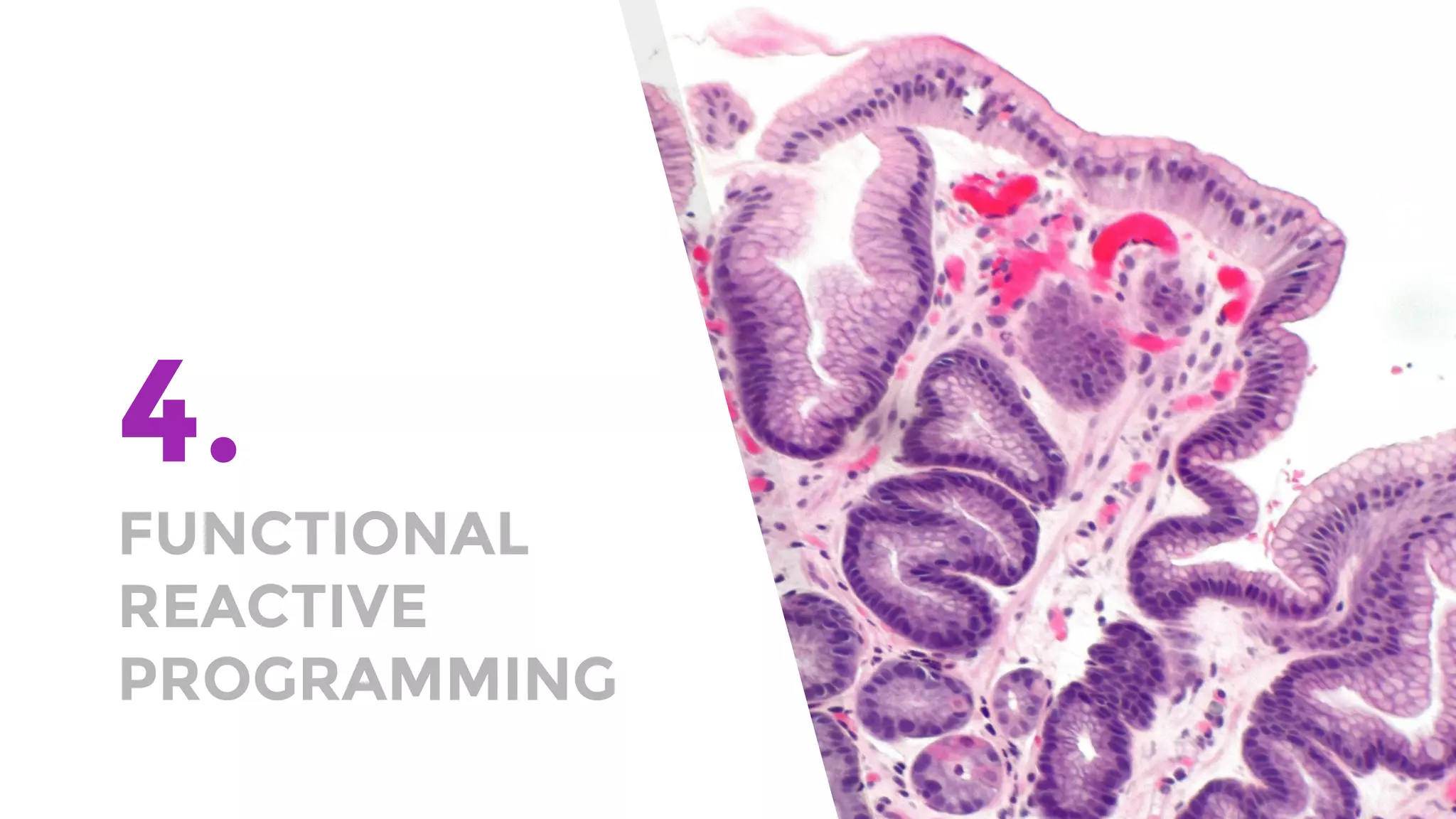 4.
FUNCTIONAL
REACTIVE
PROGRAMMING
 