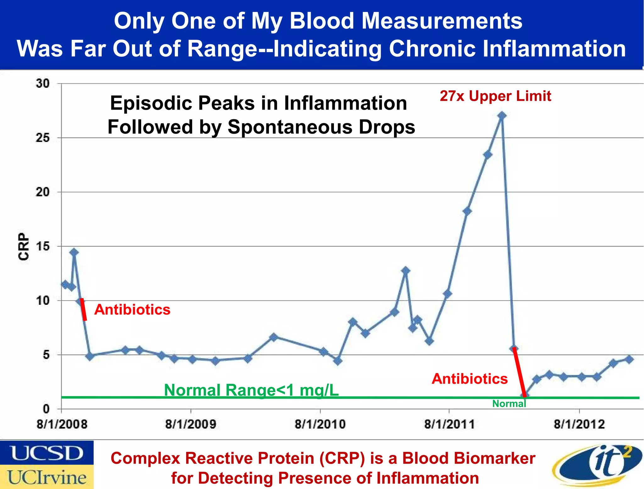 Only One of My Blood Measurements
Was Far Out of Range--Indicating Chronic Inflammation
                                               27x Upper Limit
       Episodic Peaks in Inflammation
       Followed by Spontaneous Drops




      Antibiotics



                                              Antibiotics
               Normal Range<1 mg/L
                                                      Normal




        Complex Reactive Protein (CRP) is a Blood Biomarker
              for Detecting Presence of Inflammation
 