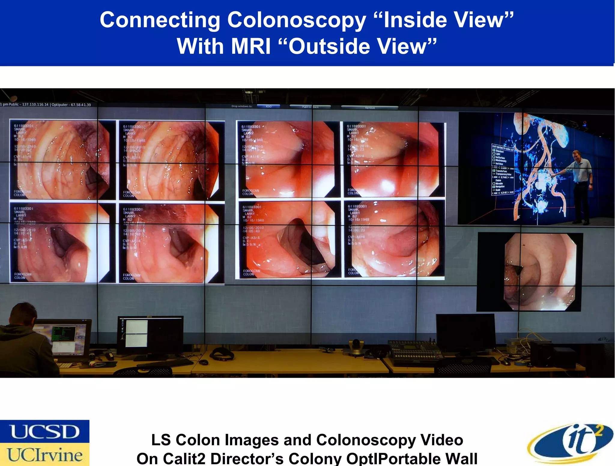 Connecting Colonoscopy “Inside View”
      With MRI “Outside View”




    LS Colon Images and Colonoscopy Video
   On Calit2 Director’s Colony OptIPortable Wall
 