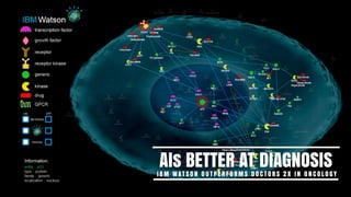 AIs BETTER AT DIAGNOSISI B M WAT S O N O U T P E R F O R M S D O C T O R S 2 X I N O N C O L O G Y
 