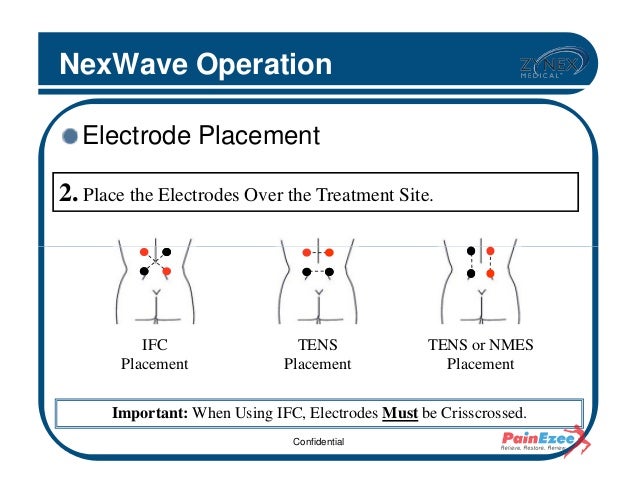 Nexwave clinical presentation